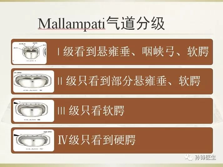 (mallampati分级)