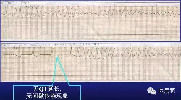 尖端扭转室速