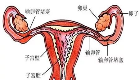 久备不孕这5类人群一定要检查输卵管