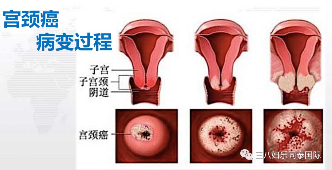 【三,宫颈】带你全面了解女性生殖系统