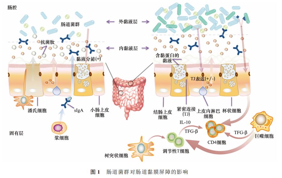 黏膜屏障系统由肠道上皮细胞连接复合体及其分泌物,肠相关免疫细胞,肠