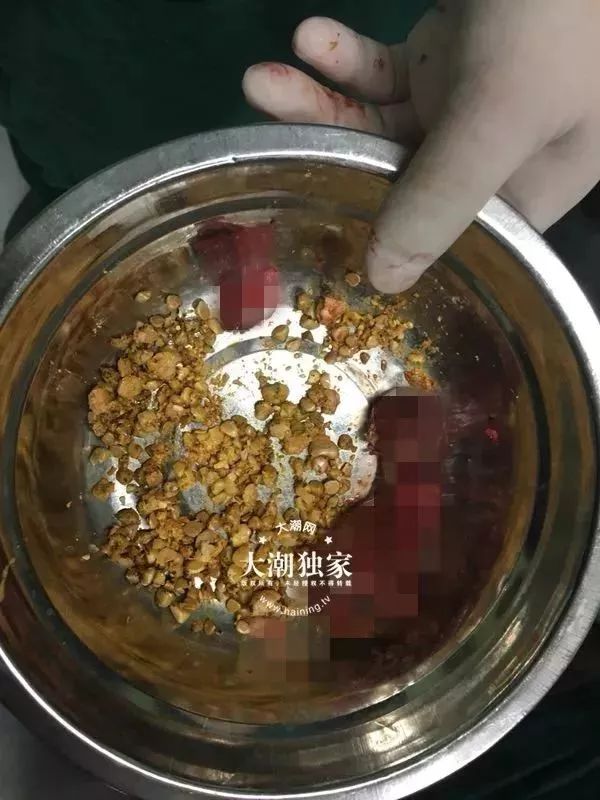 吃完螃蟹胃疼怎么办