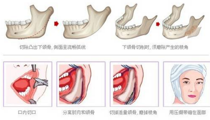 什么悔削骨成语_成语故事图片