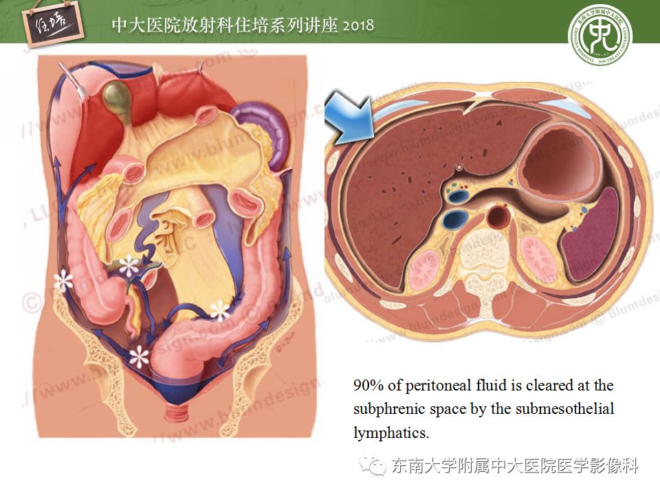 腹膜腹膜腔的影像解剖