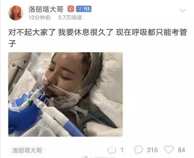 斗鱼"小热巴"整容发生事故,不小心割到大动脉,现在还插着氧气