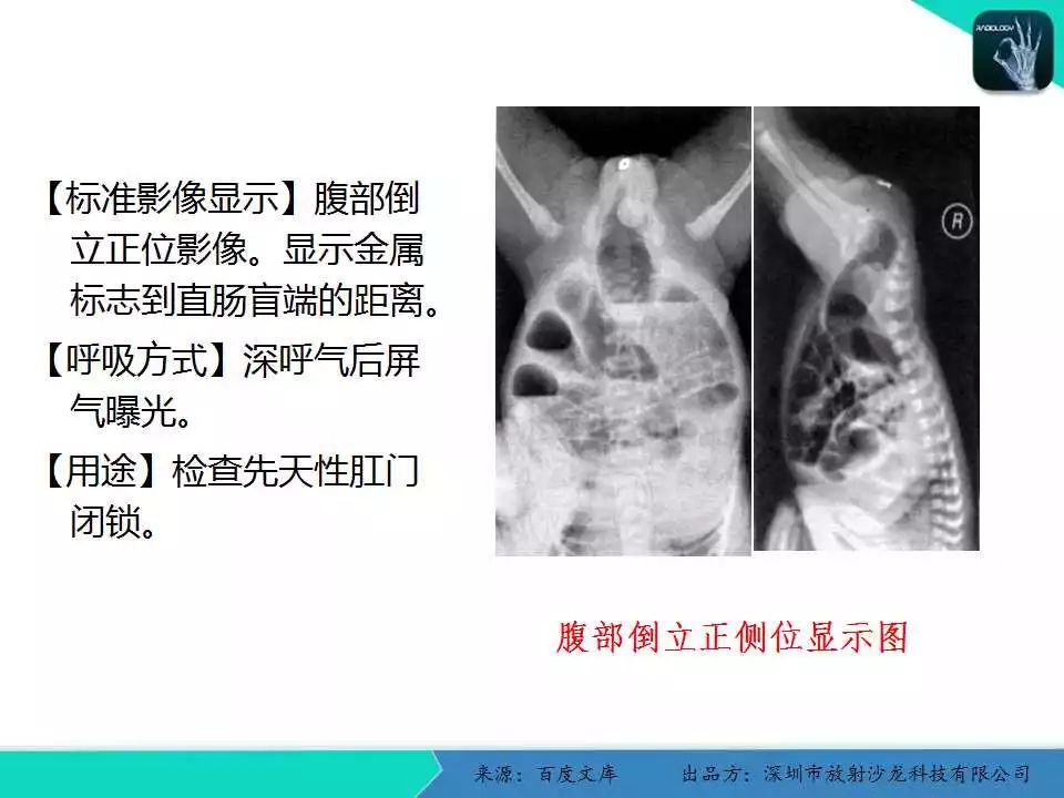 人体各部位x线摄影技术