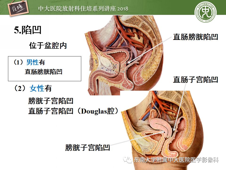 腹膜腹膜腔的影像解剖