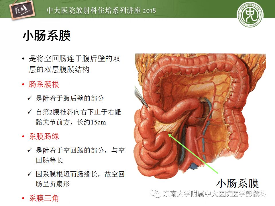 腹膜腹膜腔的影像解剖