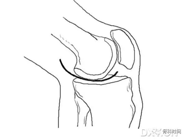 這份膝關節手繪圖譜，你一定不能錯過！ 健康 第14張