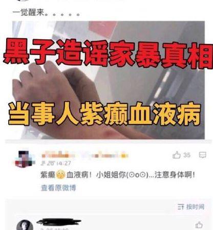 黃景瑜家暴事件再添猛料，網友圍觀吃瓜不斷，暖男真的變渣男了？ 娛樂 第11張