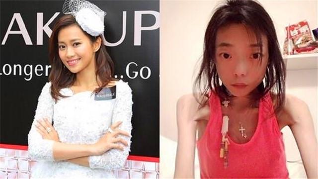 她16歲和老公戀愛，因患疾被老公拋棄，如今瘦成50斤如「紙片人」-雪花新聞