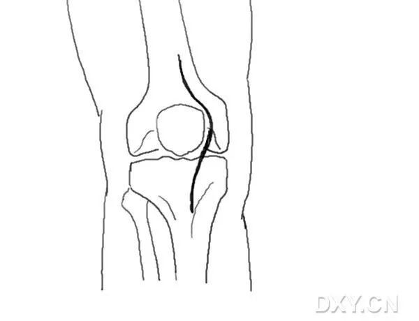 這份膝關節手繪圖譜，你一定不能錯過！ 健康 第8張