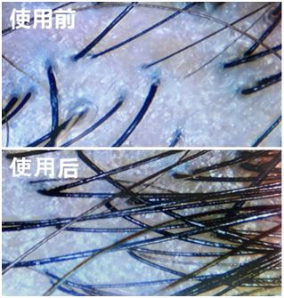 市面最火的3款防脱洗发水测评！科学告诉你们该选哪款