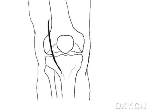 這份膝關節手繪圖譜，你一定不能錯過！ 健康 第9張