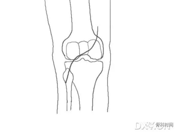 這份膝關節手繪圖譜，你一定不能錯過！ 健康 第17張