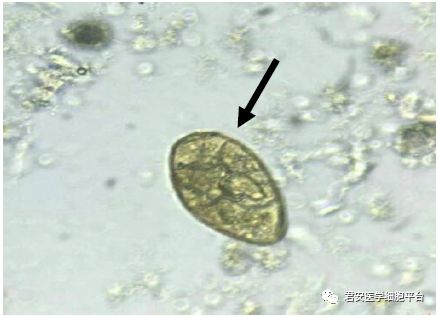 粪便涂片未染色(普通光镜)400×卫氏并殖吸虫(肺吸虫)虫卵182018418