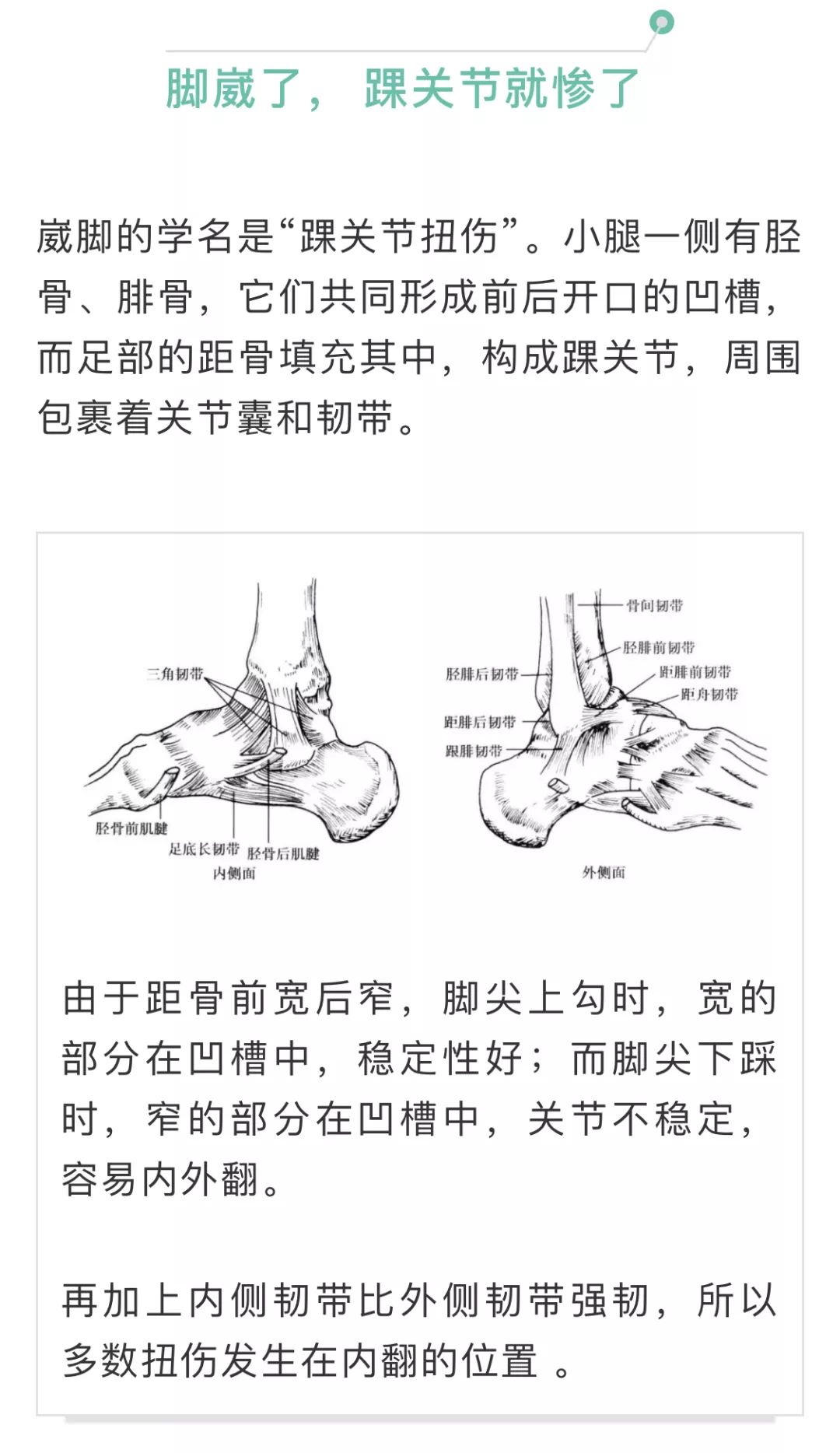 为什么崴脚的总是你?骨科医生3招挽救你的脚踝