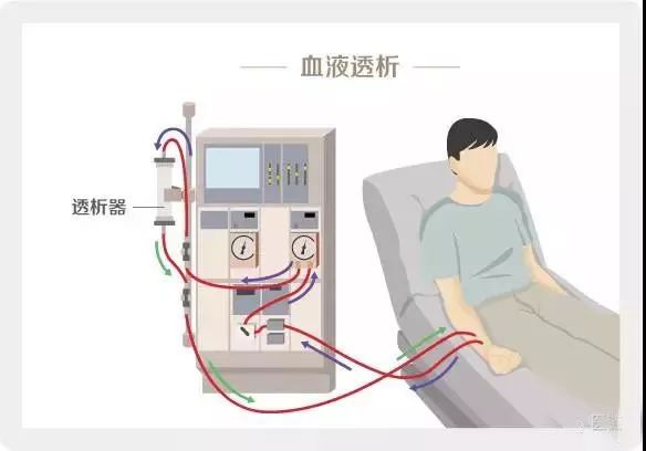 广西2018年血液透析室技术评估,快看看哪些医院进入合格名单!_血管