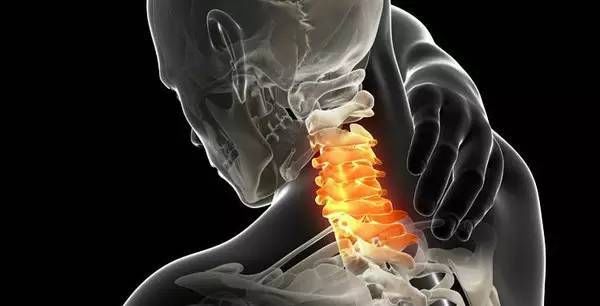 颈椎炎长期从事体力劳动者过度劳累在早期只会感觉到脖子的酸麻胀痛