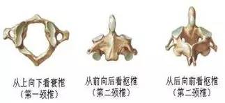 是我们常说的特异颈椎,它没有椎体和棘突 ,由前后弓和侧块组成
