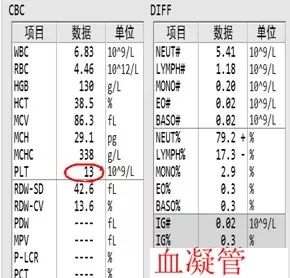 不同抗凝剂仪器计数法血小板均减低.