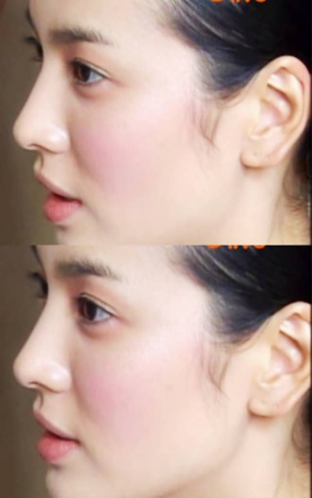 韩国整形医师选出「最理想的女星鼻子」,宋慧乔被钦点