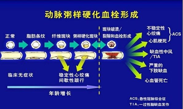 92岁老人血管壁光滑如29岁小年轻,就因每周吃三次这道