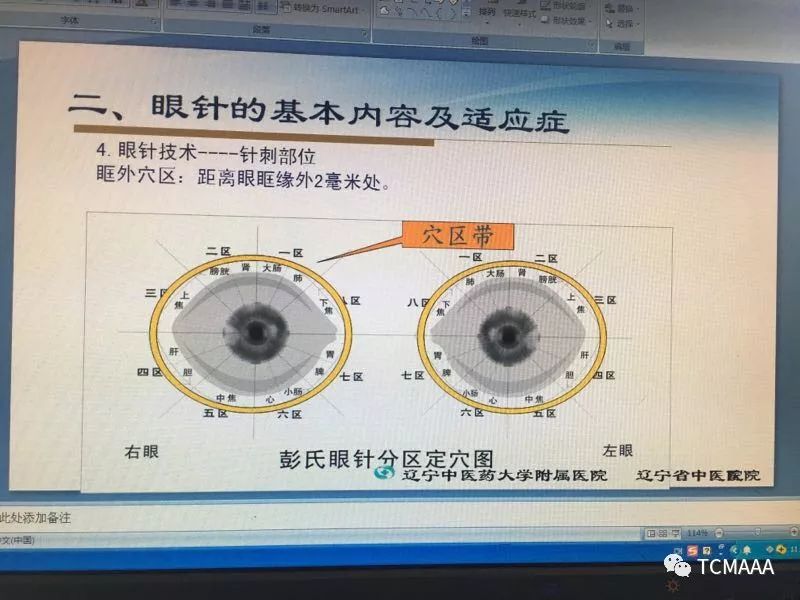 【语音讲座】眼针疗法