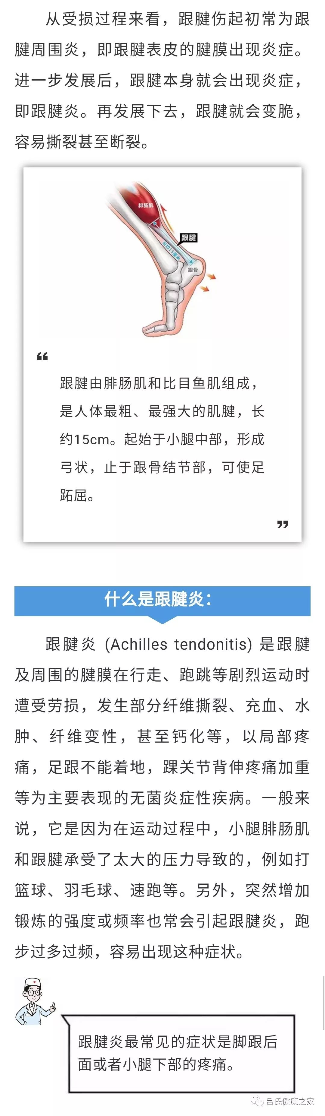 医生需要检查脚部,并可能需要进行跟腱部位的x 片检查,如果怀疑跟腱