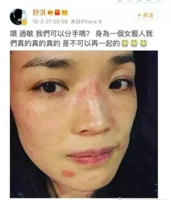 敏感肌烂脸必看如何对抗换季过敏皮肤