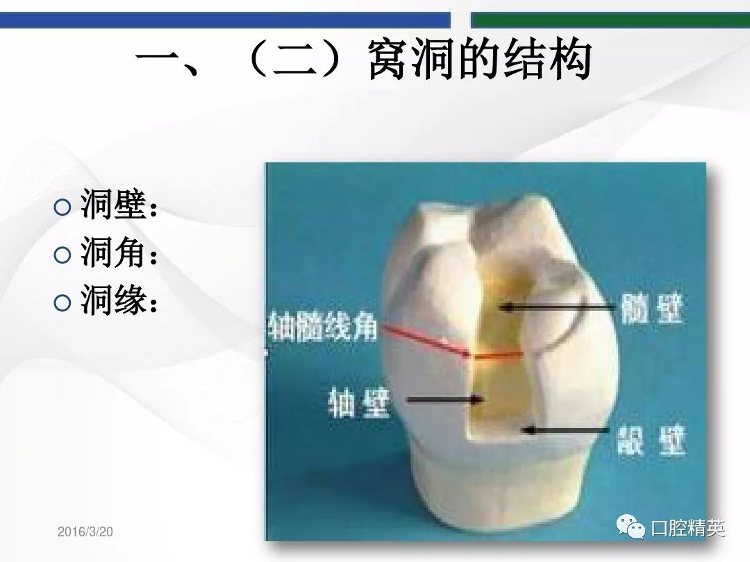 窝洞制备