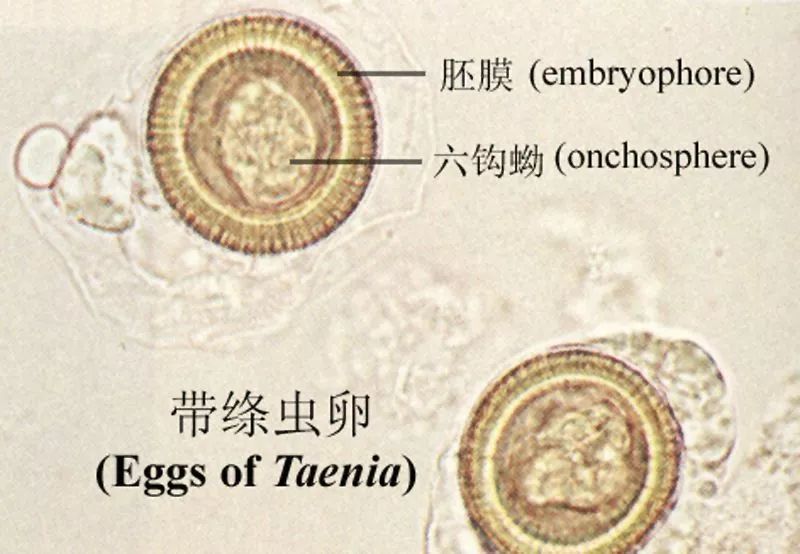从带绦虫卵的模式图,我们可以见到圆形的卵壳,胚膜及六钩蚴.