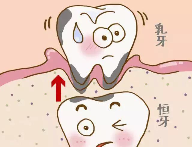 刷牙 不吃糖=不蛀牙?儿童口腔健康五大误区,您中招了么?