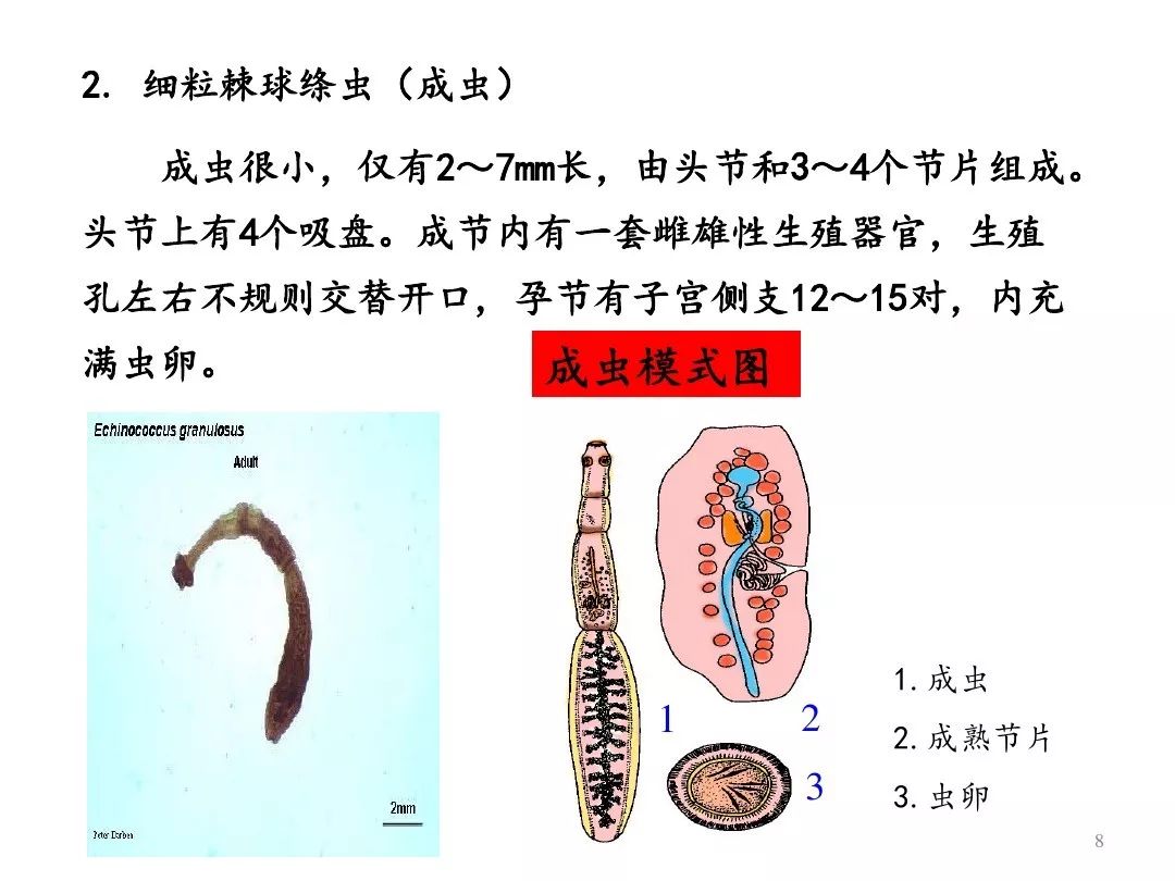 【包虫病预防知识】包虫病宣传片《格桑花开》:2-雪上