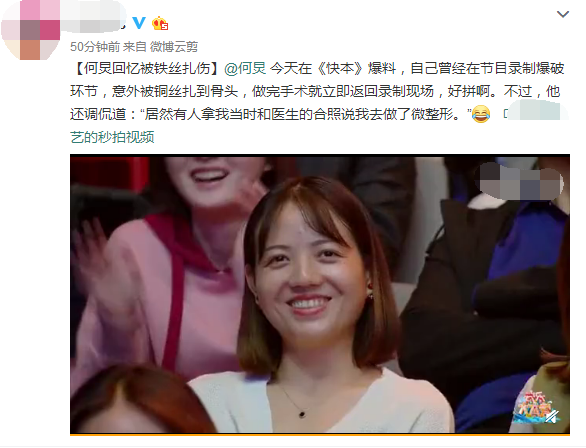 何炅澄清微整形：爆炸時銅絲插進肉裡，打麻藥做手術，謝娜現場笑噴 娛樂 第3張