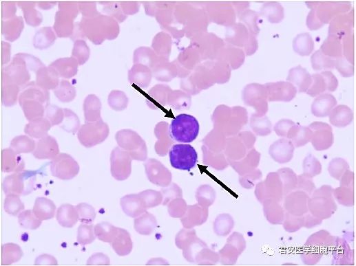 外周血,瑞氏染色淋巴细胞0820180108箭头所指"物"名称外周血,瑞氏染色