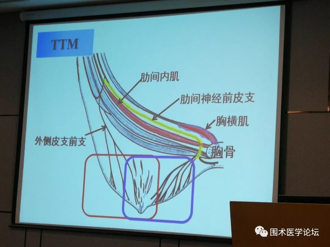 超声引导胸部及腹部阻滞_骨神经