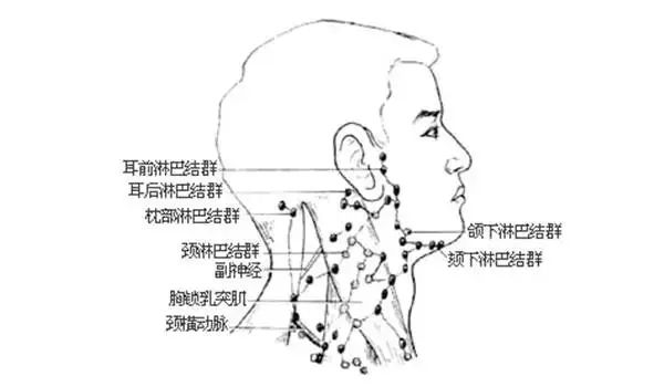 淋巴结大怎么办