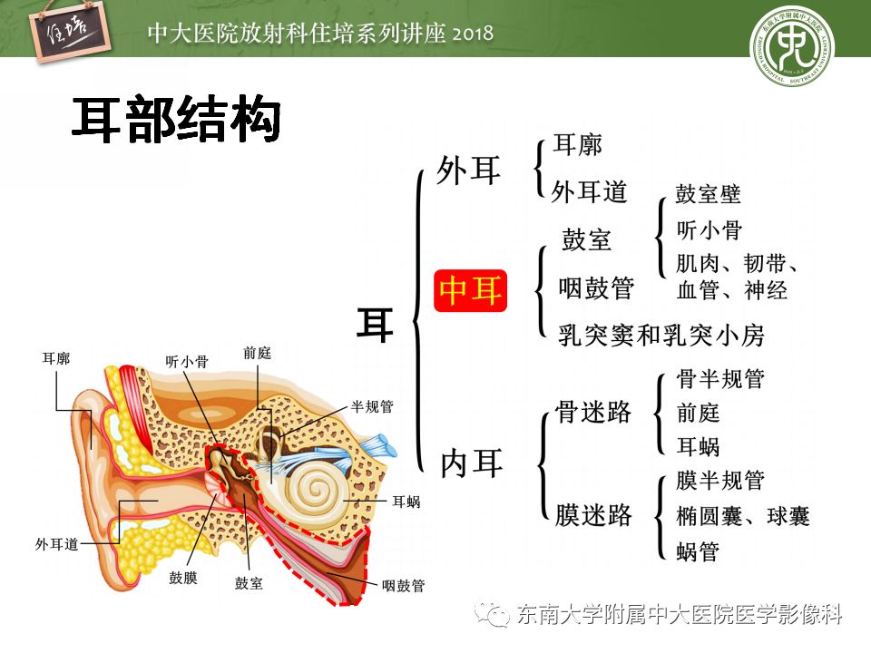 中耳解剖及中耳病变影像诊断