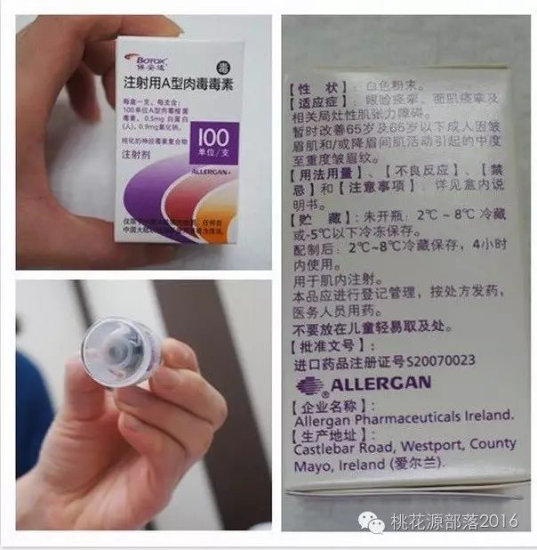 二,国外fda及国内cfda均有认证的a型肉毒素品牌-botox(保妥适)