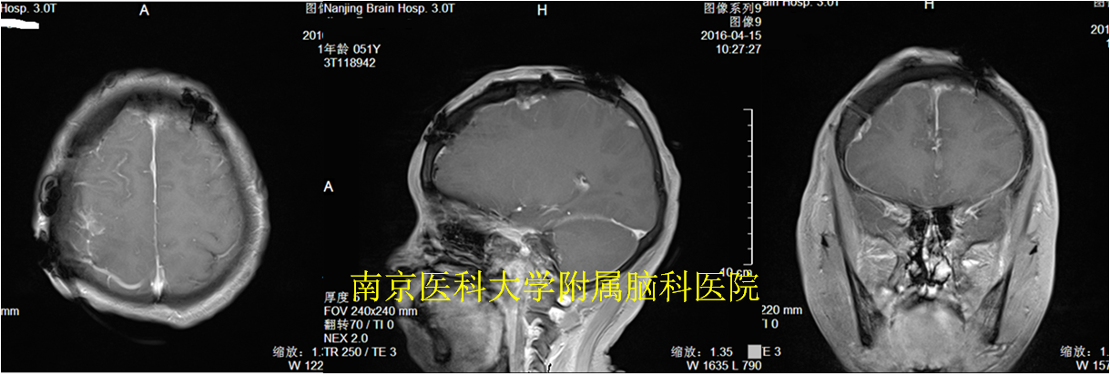 南京市脑科医院好不好啊