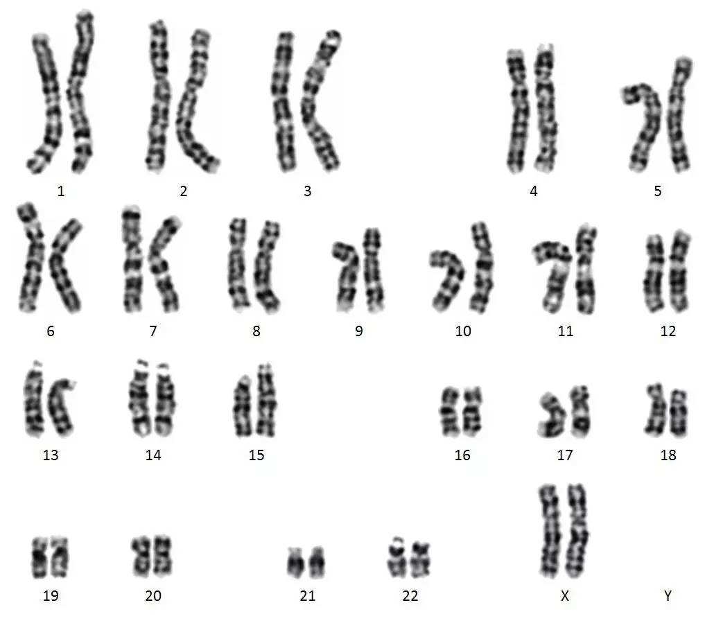什么是染色体核型分析？为什么要做这项检查？_流产