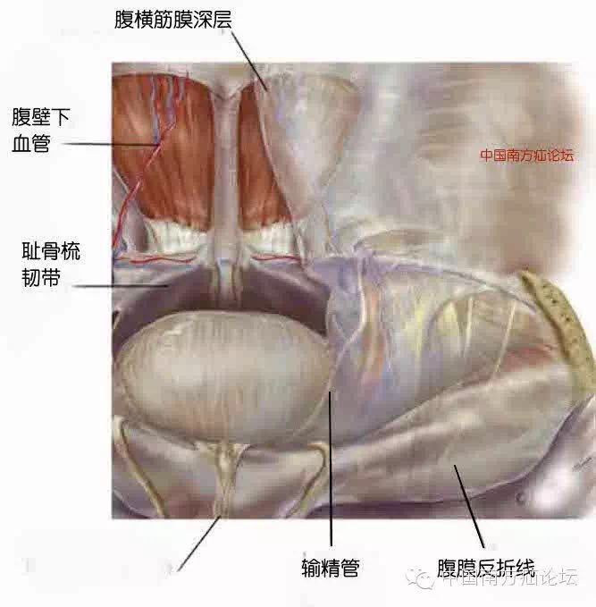 基础|腔镜下腹股沟疝解剖(二)间隙篇 (转载)