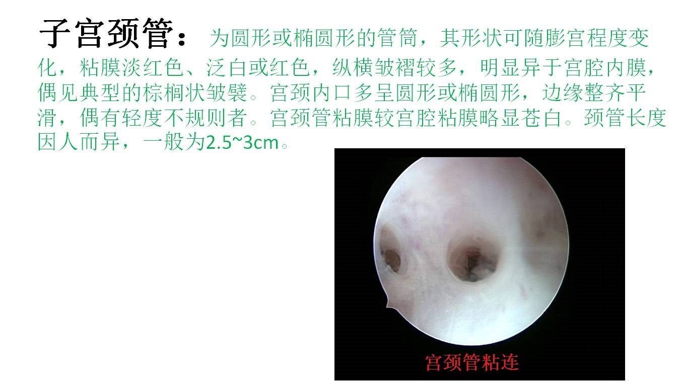 正常宫腔描述及异常宫腔图片(图文不对应)