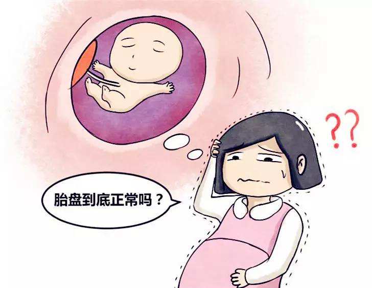 孕妇前置胎盘怎么办?