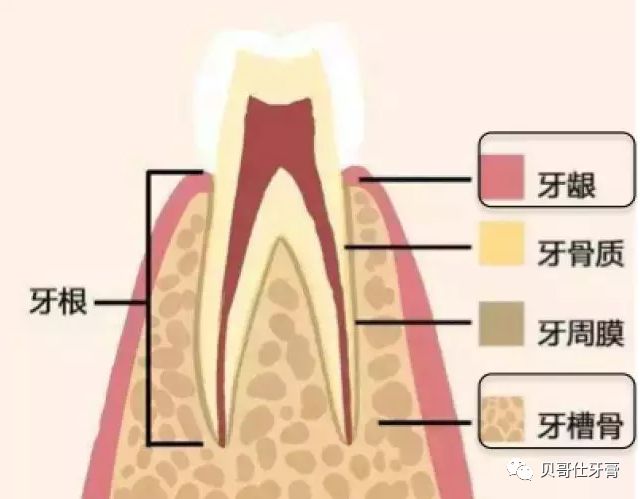 菌斑与牙龈紧密接触,引起牙周炎,牙结石的多孔结构又容易吸收大量的