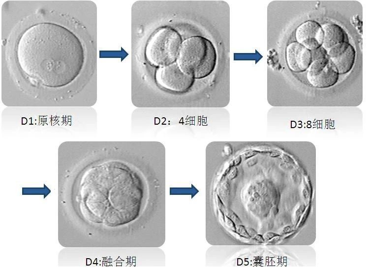 胚胎移植原理是什么_胚胎是什么样子的图片