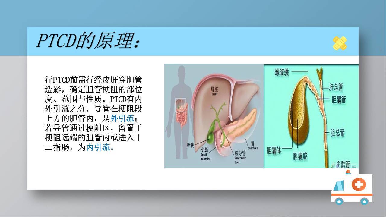 ptcd术后的引流管如何进行护理