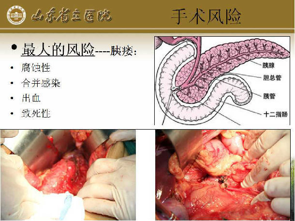 脾什么什么切成语_成语故事简笔画(3)