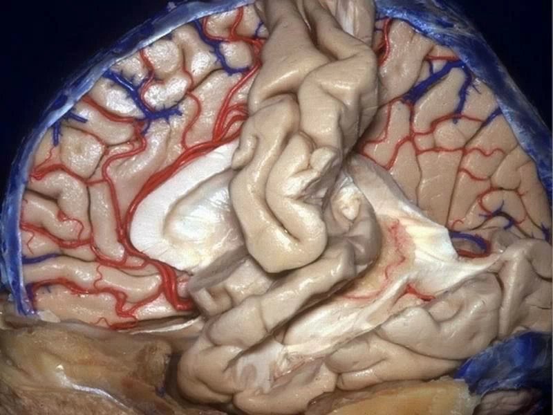 3d解剖图像展现大脑组织 (转载)